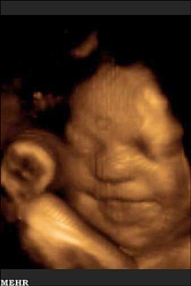 خنده ی جنین در شکم مادر + عکس